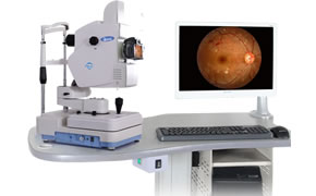 FS-C1  眼底彩色照相檢查儀